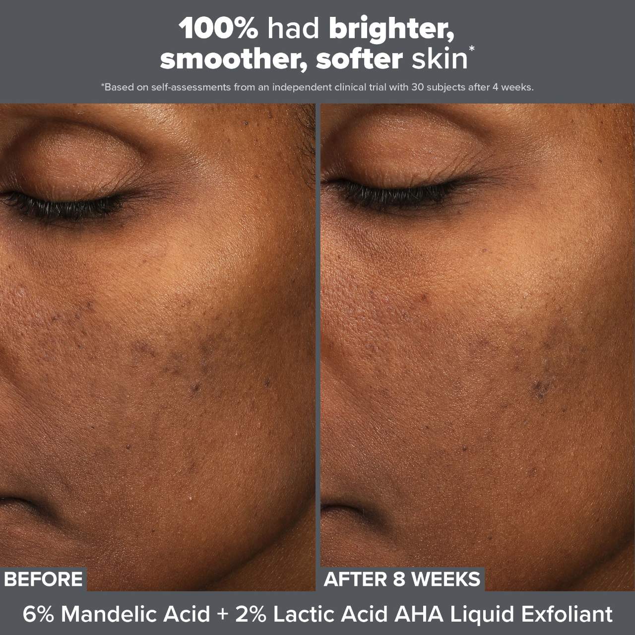 Paula's Choice - Smooth & Glow Exfoliating Duo for Clear and Brighter looking skin